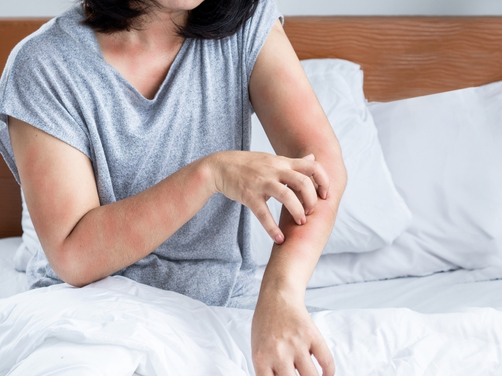 Health Issues Caused By Bird Mites